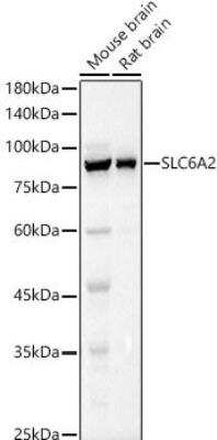 Western Blot: SLC6A2/NET/Noradrenaline transporter AntibodyAzide and BSA Free [NBP2-93180]