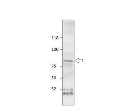 Western Blot: SLC6A2/NET/Noradrenaline transporter Antibody [NBP3-12251]