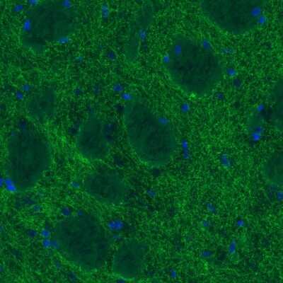 Immunohistochemistry: SLC6A3/DAT1 Antibody (CL3123) [NBP2-46649]