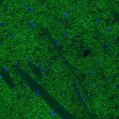 Immunohistochemistry: SLC6A3/DAT1 Antibody (CL3123) [NBP2-46649]