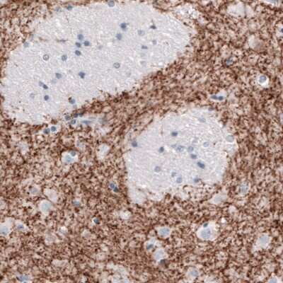 Immunohistochemistry-Paraffin: SLC6A3/DAT1 Antibody (CL3123) [NBP2-46649]