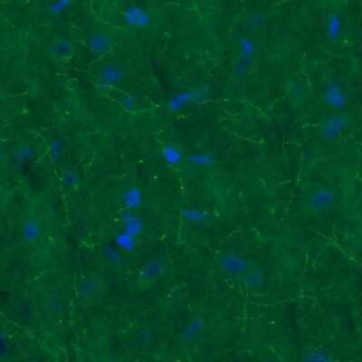 Immunohistochemistry: SLC6A3/DAT1 Antibody (CL3123) [NBP2-46649]