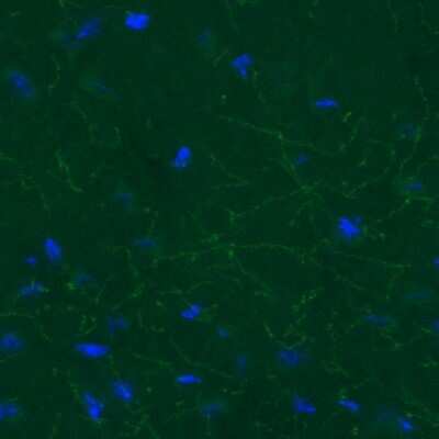 Immunohistochemistry: SLC6A3/DAT1 Antibody (CL3123) [NBP2-46649]