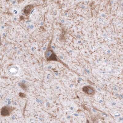 Immunohistochemistry-Paraffin: SLC6A3/DAT1 Antibody (CL3123) [NBP2-46649]