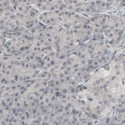 Immunohistochemistry-Paraffin: SLC6A3/DAT1 Antibody (CL3123) [NBP2-46649]