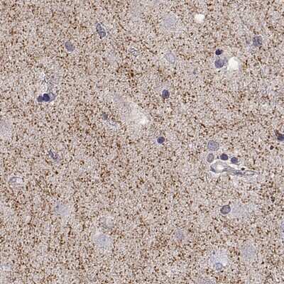 Immunohistochemistry-Paraffin: SLC6A3/DAT1 Antibody [NBP2-68583]