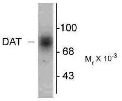 Western Blot: SLC6A3/DAT1 Antibody [NB300-254]