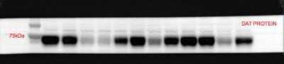 Western Blot: SLC6A3/DAT1 Antibody (mAb16)Azide and BSA Free [NBP2-80954]