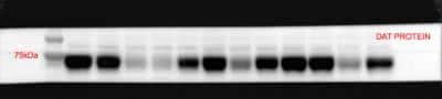 Western Blot: SLC6A3/DAT1 Antibody (mAb16) [NBP2-22164]