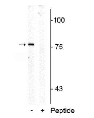 Western Blot: SLC6A4/5-HTTLPR/Serotonin transporter [p Thr276] Antibody [NBP2-60778]