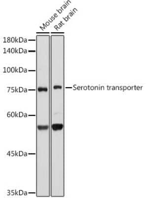 Western Blot: SLC6A4/5-HTTLPR/Serotonin transporter Antibody (5T7M2) [NBP3-15668]