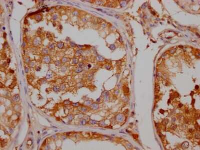 Immunohistochemistry: SLC6A4/5-HTTLPR/Serotonin transporter Antibody (9G3) [NBP3-15198]