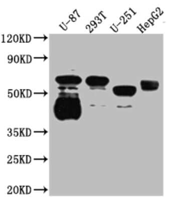 Western Blot: SLC6A4/5-HTTLPR/Serotonin transporter Antibody (9G3) [NBP3-15198]