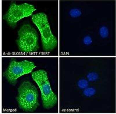 Immunocytochemistry/ Immunofluorescence: SLC6A4/5-HTTLPR/Serotonin transporter Antibody [NB100-1892]