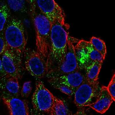 Immunocytochemistry/ Immunofluorescence: SLC6A4/5-HTTLPR/Serotonin transporter Antibody [NBP2-57729]