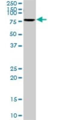 Western Blot: SLC6A4/5-HTTLPR/Serotonin transporter Antibody [H00006532-D01P]