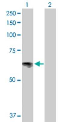 Western Blot: SLC6A4/5-HTTLPR/Serotonin transporter Antibody [H00006532-D01P]