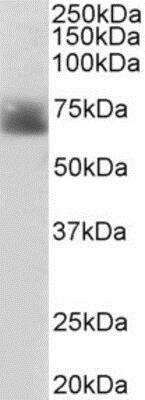 Western Blot: SLC6A4/5-HTTLPR/Serotonin transporter Antibody [NB100-1892]