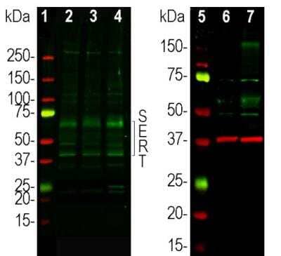 Western Blot: SLC6A4/5-HTTLPR/Serotonin transporter Antibody [NBP3-05546]