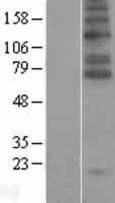 Western Blot: GlyT2/SLC6A5 Overexpression Lysate [NBL1-16181]