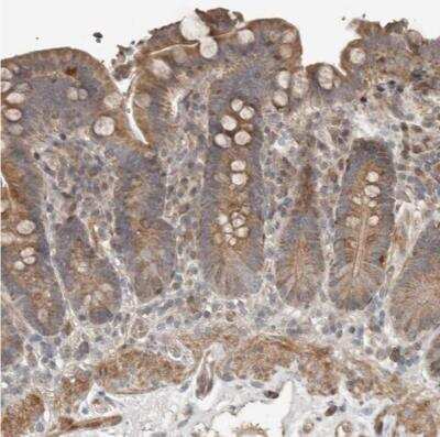 Immunohistochemistry-Paraffin: SLC6A7 Antibody [NBP1-87216]