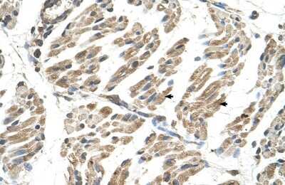 Immunohistochemistry: SLC6A8 Antibody [NBP1-60082]