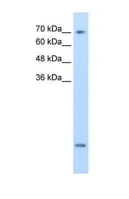 Western Blot: SLC6A8 Antibody [NBP1-60082]