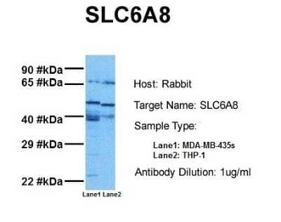 Western Blot: SLC6A8 Antibody [NBP1-60082]