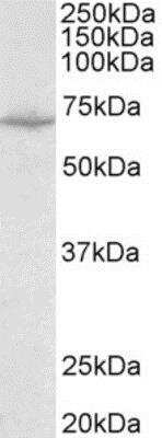 Western Blot: SLC6A8 Antibody [NBP2-11567]