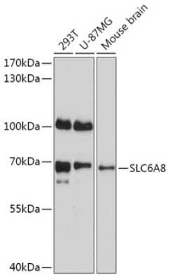 Western Blot: SLC6A8 AntibodyAzide and BSA Free [NBP2-94178]