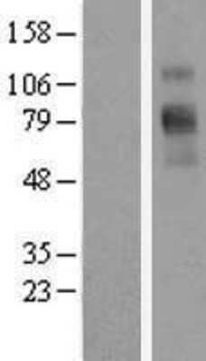 Western Blot: GlyT1/SLC6A9 Overexpression Lysate [NBL1-16183]