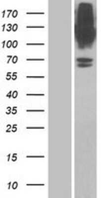 Western Blot: GlyT1/SLC6A9 Overexpression Lysate [NBP2-07554]