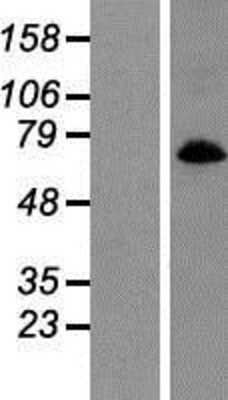 Western Blot: GlyT1/SLC6A9 Overexpression Lysate [NBP2-09172]