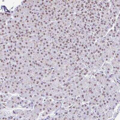 Immunohistochemistry-Paraffin: SLC7A10 Antibody [NBP2-38816]