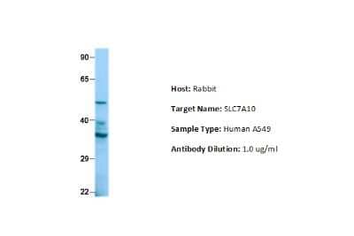 Western Blot: SLC7A10 Antibody [NBP2-85763]