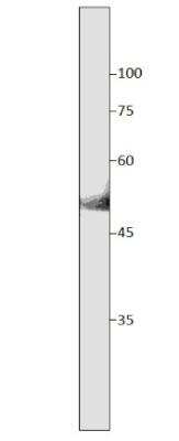 Western Blot: SLC7A10 Antibody [NBP3-12253]