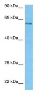 Western Blot: SLC7A13 Antibody [NBP3-10159]