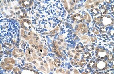 Immunohistochemistry-Paraffin: SLC7A14 Antibody [NBP1-59892]