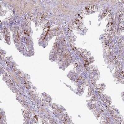 Immunohistochemistry-Paraffin: SLC7A14 Antibody [NBP2-13346]