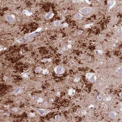 Immunohistochemistry-Paraffin: SLC7A14 Antibody [NBP2-13346]