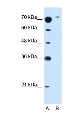 Western Blot: SLC7A14 Antibody [NBP1-59892]