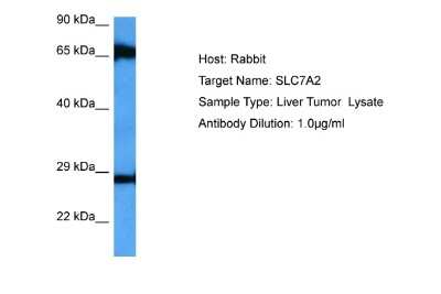 Western Blot: SLC7A2 Antibody [NBP2-85764]