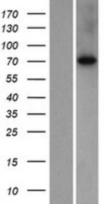 Western Blot: SLC7A2 Overexpression Lysate [NBP2-08685]