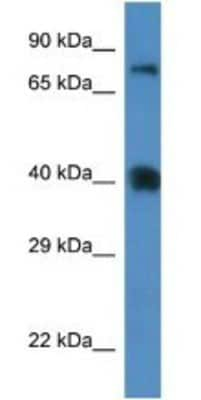 Western Blot: CAT3/SLC7A3 Antibody [NBP1-74144]