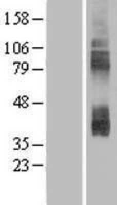 Western Blot: CAT3/SLC7A3 Overexpression Lysate [NBP2-05969]