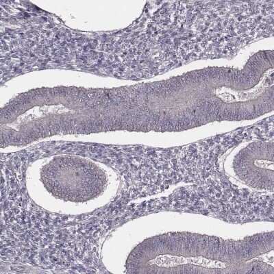 Immunohistochemistry-Paraffin: SLC7A4 Antibody [NBP1-86613]