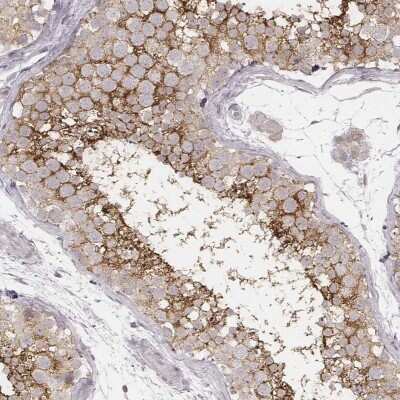 Immunohistochemistry-Paraffin: SLC7A4 Antibody [NBP1-86613]