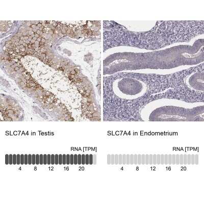 Immunohistochemistry-Paraffin: SLC7A4 Antibody [NBP1-86613]