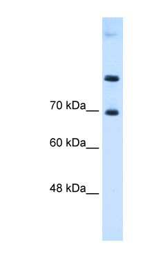 Western Blot: SLC7A4 Antibody [NBP1-59750]