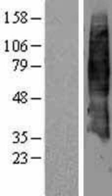 Western Blot: SLC7A4 Overexpression Lysate [NBL1-16187]